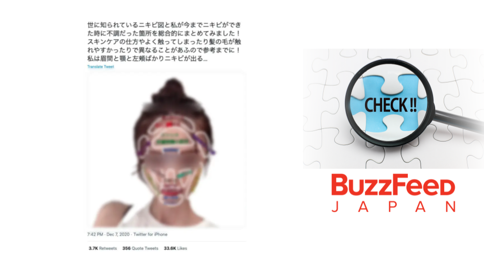 ニキビの位置で体の不調がわかる と図が拡散 専門医 全くの都市伝説 Buzzfeed Japan Factcheck Navi